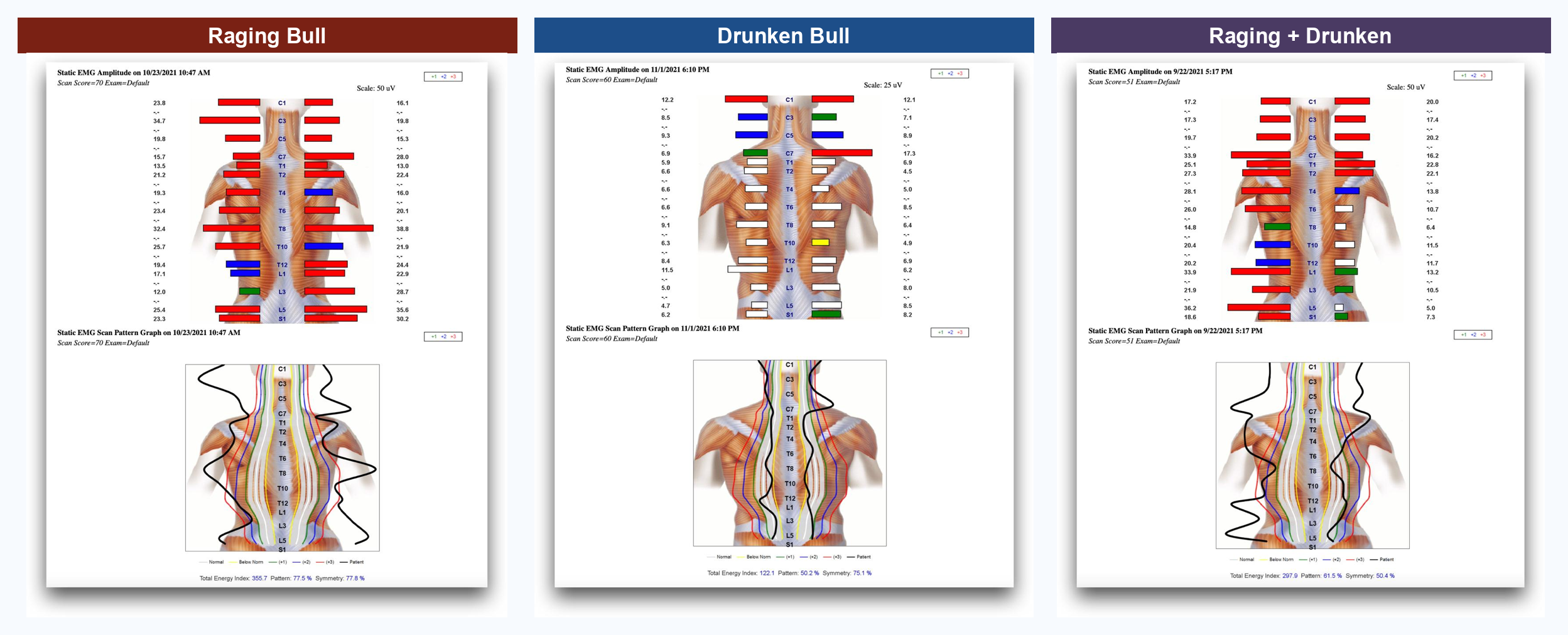 Three real surface-EMG scans: drunken bull, raging bull, and mixed patterns