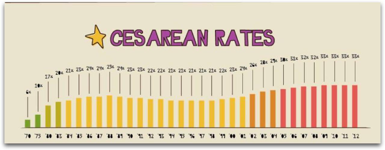 Chart of rising cesarean-section rates over time