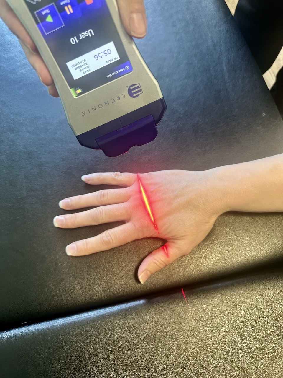Cold laser therapy being used during a Van Every visit